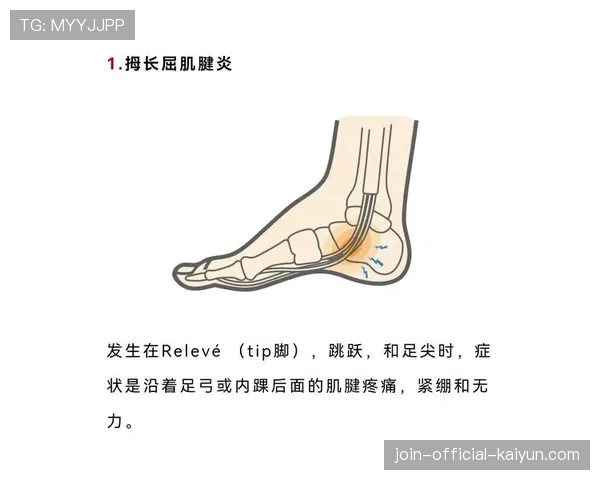 联盟伤病统计月报：热点伤病及预防建议，伤病汇总